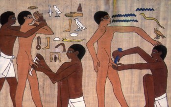 Circoncision pharaonique (ou infibulation), Egypte