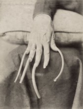 China, hand with uncut nails