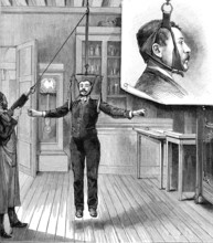 Traitement de L'ATAXIE