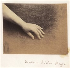 Adèle Foucher's hand