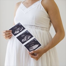 Pregnant woman holding ultrasound printout.