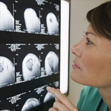 Close up of female technician examining x-ray.