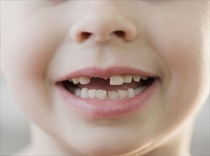 Portrait of boy with missing teeth.