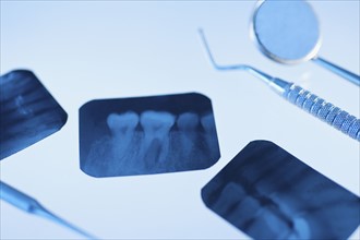 Dental instruments and x-rays.