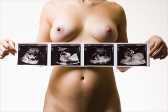 Studio shot of naked pregnant woman holding ultrasonography picture. Photo : Noah Clayton