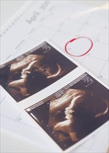 Sonogram picture and calendar with due date. Photo: Jamie Grill Photography