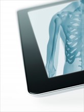 Studio shot of digital tablet with x-ray of human chest. Photo : David Arky