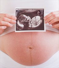 Pregnant woman with ultrasonography scan. Photo : Daniel Grill