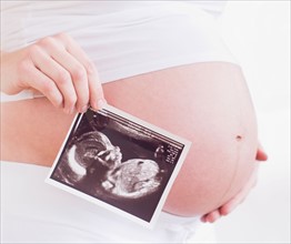 Pregnant woman with ultrasonography scan. Photo : Daniel Grill