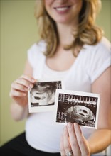 pregnant woman showing sonograms. 
Photo : Jamie Grill