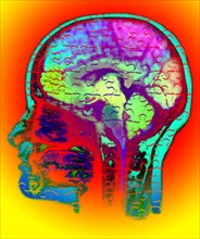 Conceptual image of human brain. 
Photo: Calysta Images