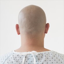 Back view of patient with shaved head.