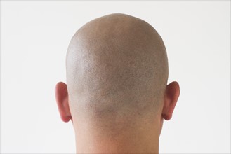 Back view of man with shaved head.