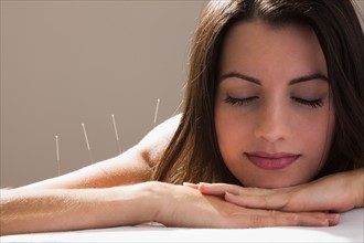 Close-up of woman with acupuncture needles in her arm and shoulders. Photo : Mike Kemp