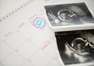 Studio Shot of ultrasound picture lying on calendar