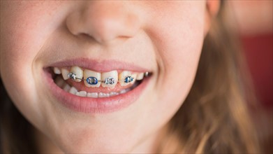 Close up of girl's (8-9) mouth with braces.