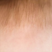 Close-up of baby boy's (2-5 months) forehead.