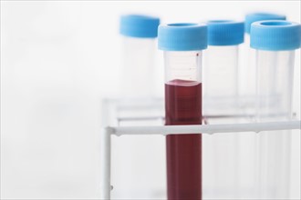 Blood sample in test tube.