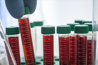 Vials of blood in lab