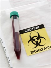 Blood sample with biohazard sign