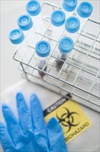 Blood samples with biohazard sign and surgical glove