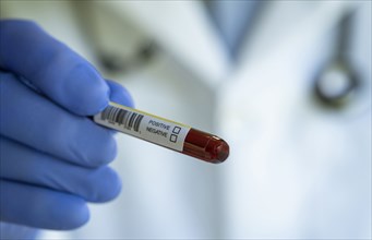 Close-up of doctors hand holding blood sample