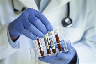 Close-up of doctors hands holding test tube rack with blood samples