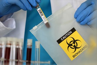 Lab professional putting vial into string bag with biohazard sign