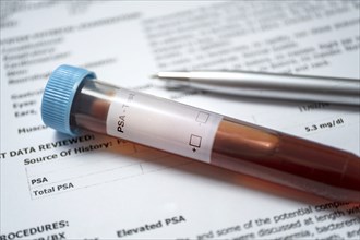 Studio shot of prostate cancer document and blood sample