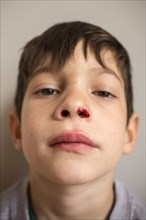 Portrait of Mixed Race boy with bloody nose