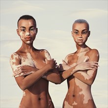 Women with vitiligo