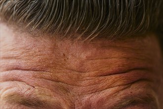 Close up of wrinkled forehead of Caucasian man