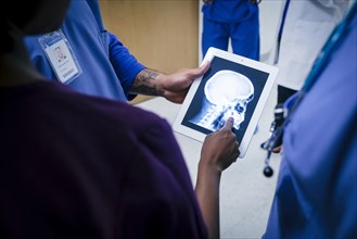 Doctors examining x-ray of skull and jaw on digital tablet