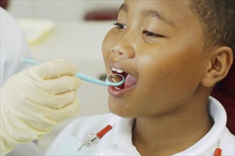 Dentist's hand holding dental mirror in boy's mouth