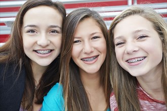 Teenage girls showing off braces together