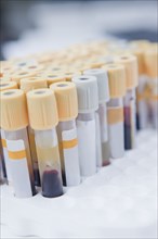 Close up of blood samples in test tube rack in laboratory