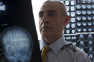 Hispanic doctor examining x-ray of skull