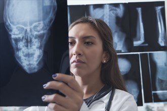 Hispanic doctor examining x-ray of skull