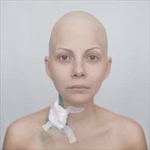 Bald Caucasian cancer patient with bandage on neck