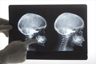 Doctor examining x-rays in hospital