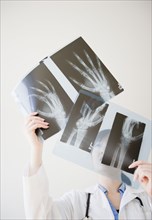 Korean doctor looking at x-rays of hand bones
