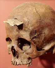 Skull of a 20 year old woman which still holds the point that killed her