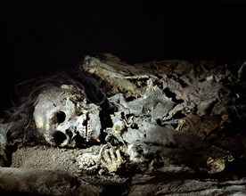 Skeleton of a man