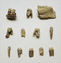 Homo antecessor, Teeth and jaw fragments of an adolescent male between 13 and 14 years old (Hominid 1)