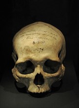 Human skull located in a funerary mound.