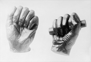 Cast of Abraham Lincoln's right hand ca. between 1909 and 1919