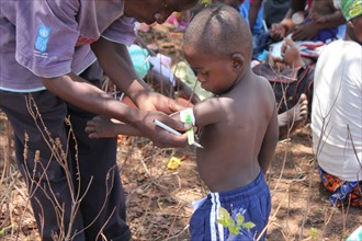 A village health worker in Zimbabwe checks a child's Mid-Upper Arm Circumference ca. 30 November 2016
