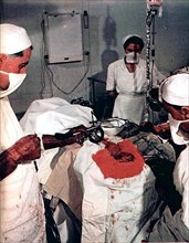 1950 operating room in Milan