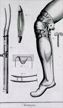 Devices for foot and leg injuries ca. 1700s