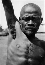 africa, congo belga, particolare della folta e dura pelosità dell'ascella dei pigmei, 1927 1930